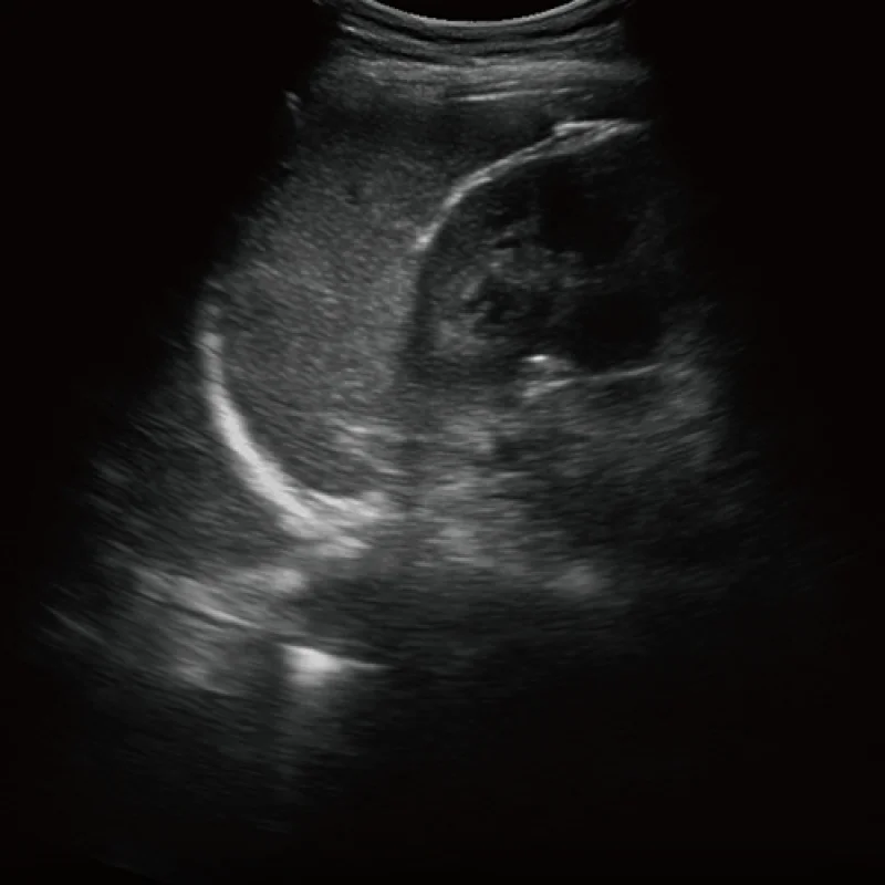 Clinical Image