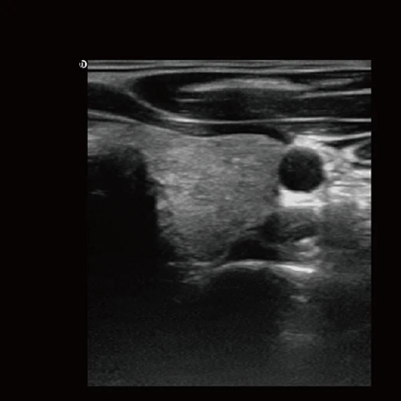 Clinical Image