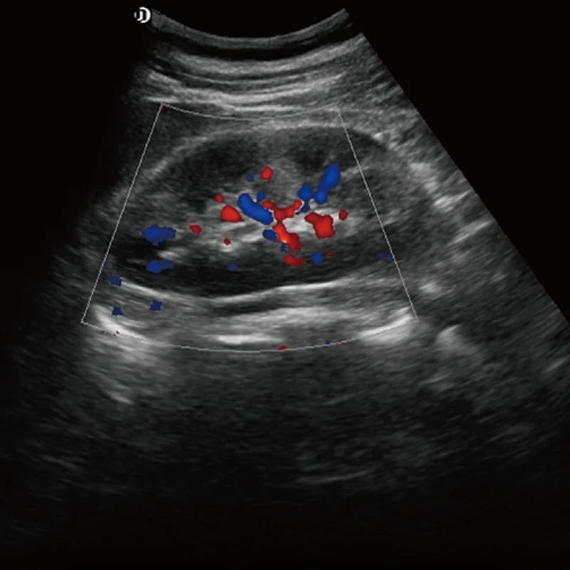 Clinical Image