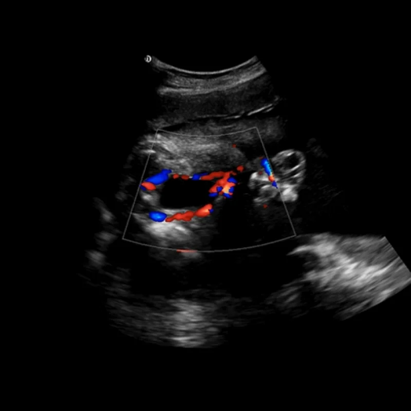 Clinical Image
