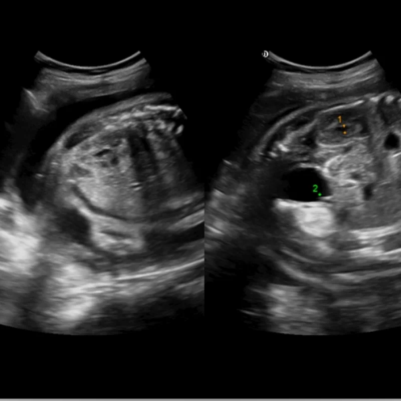 Clinical Image