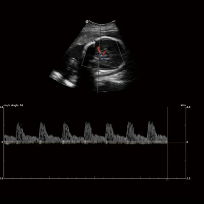 Clinical Image