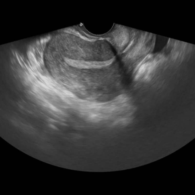 Clinical Image
