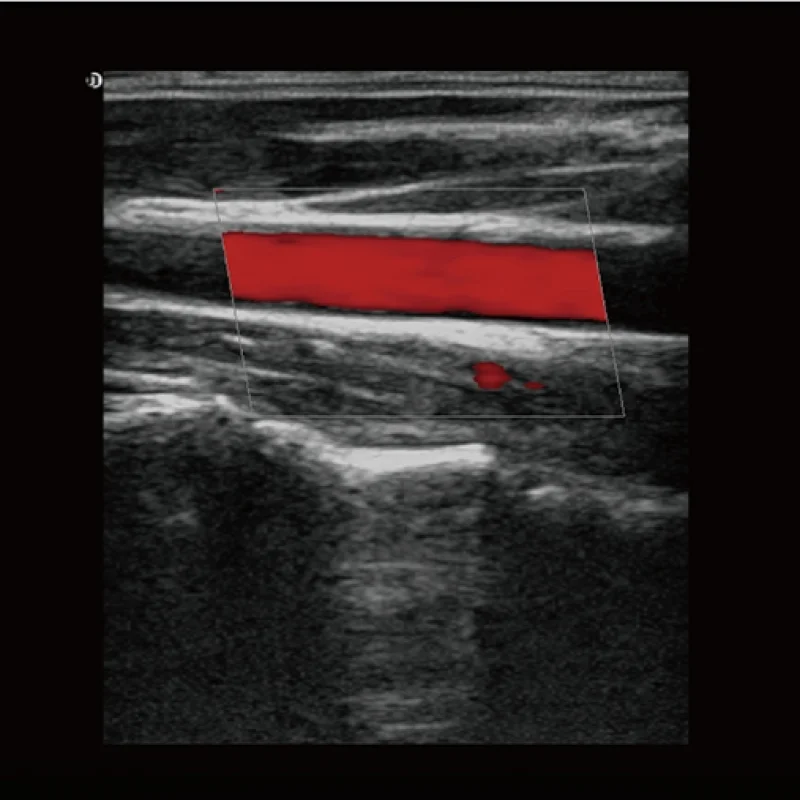 Clinical Image