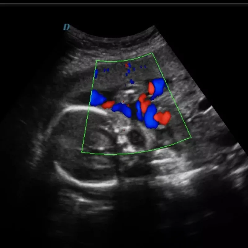Clinical Image