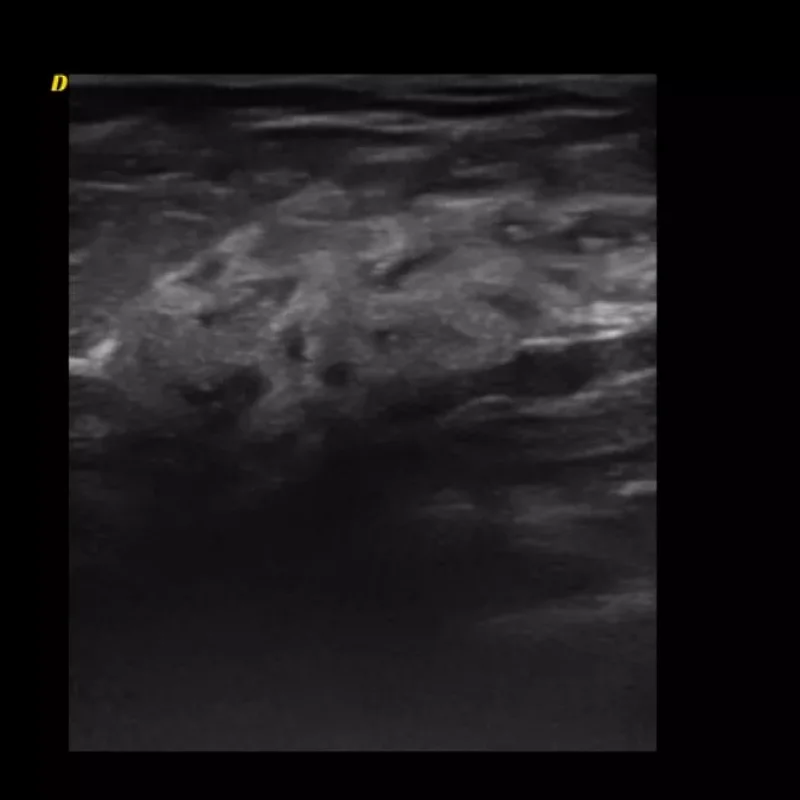 Clinical Image