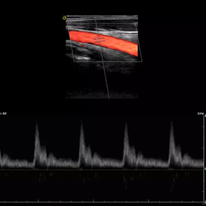 Clinical Image