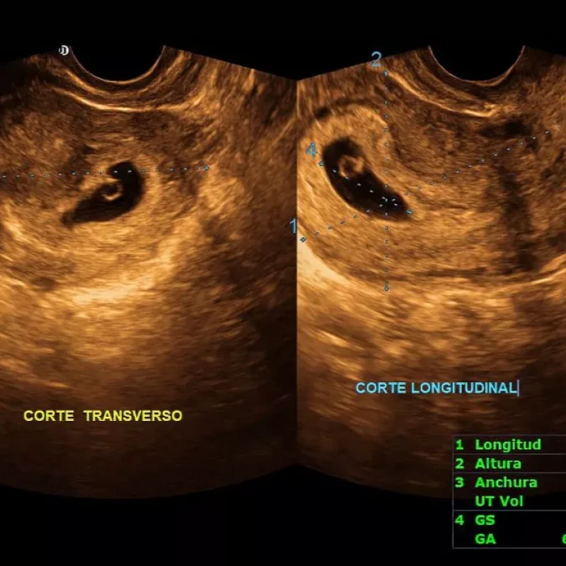 Clinical Image
