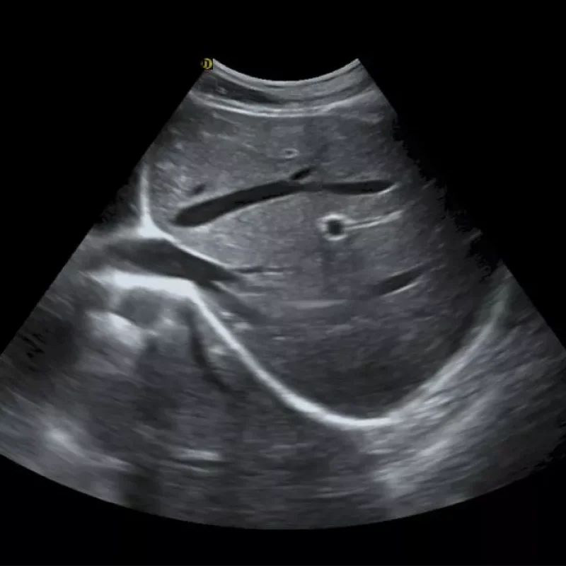 Clinical Image