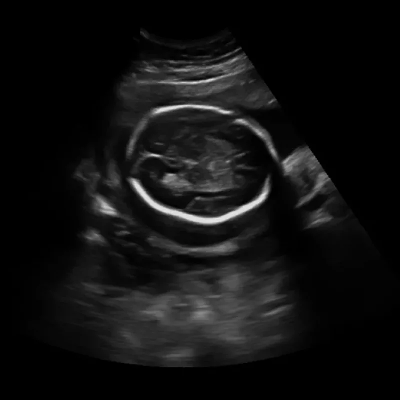 Clinical Image