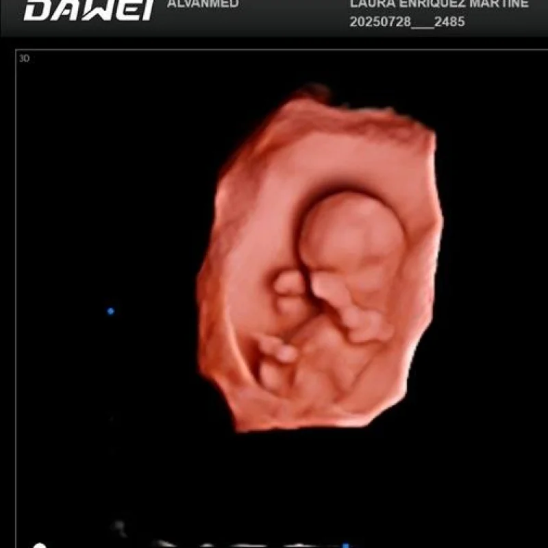 Clinical Image