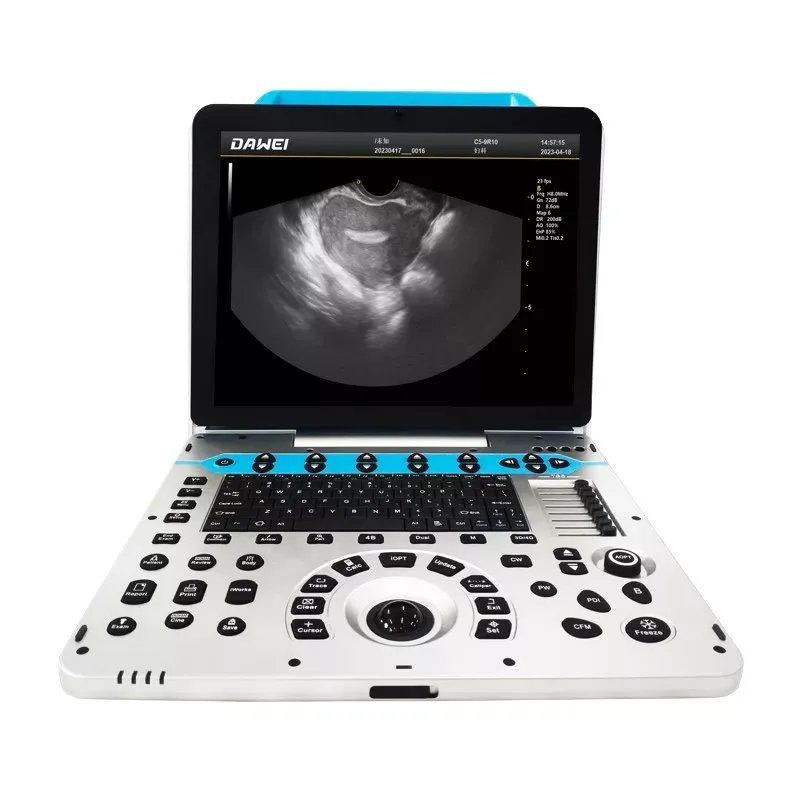 Máy Siêu âm xách tay 4D DW P30